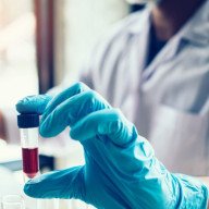 Vigilancia epidemiológica por casos de meningitis en la provincia