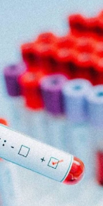 Aumentan los casos de sífilis en Salta