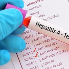En Salta ya suman 10 casos de Hepatitis A 
