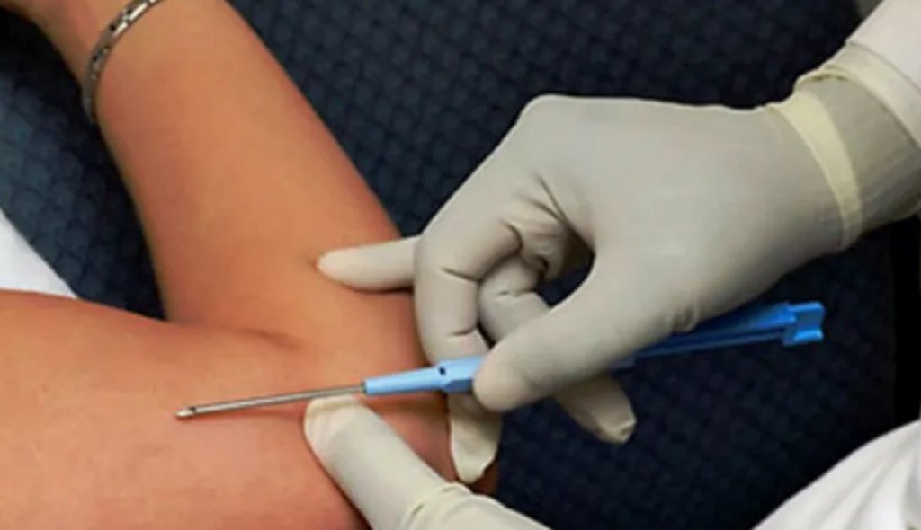 Colocación de implantes subdérmicos en la Usina Cultural