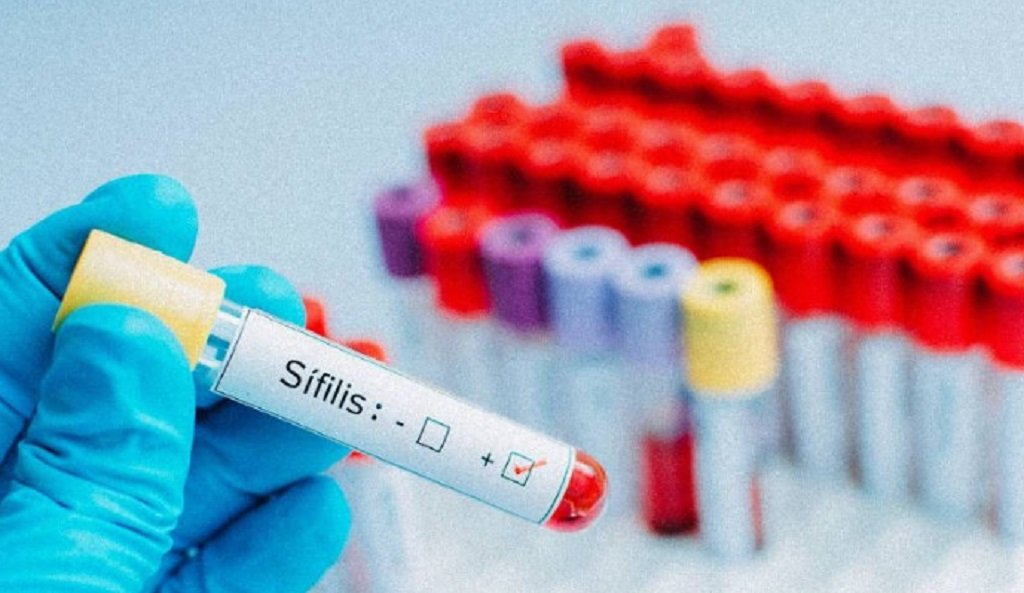 Aumentan los casos de sífilis en Salta